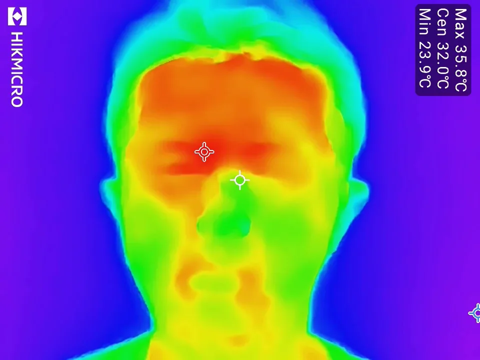 サーモカメラで見たTearmoreを外した直後の顔、最高35.8℃